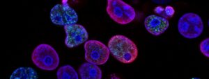 Microscope image of cells used in colorectal cancer research